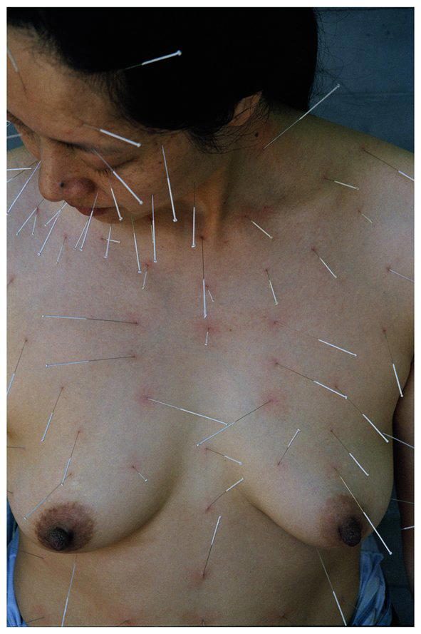 «99 Needles», 2002